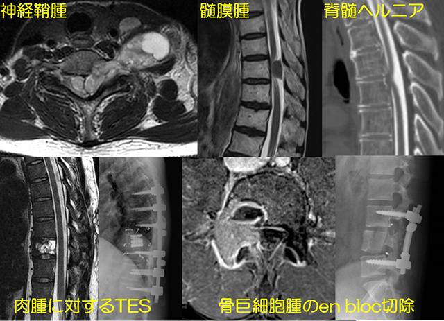 脊椎・脊髄診 | 組織のご紹介 | 整形外科・脊椎外科 東京大学医学部附属病院