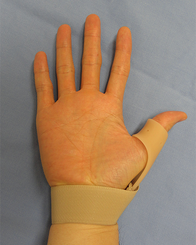 母指CM関節症対処法の例